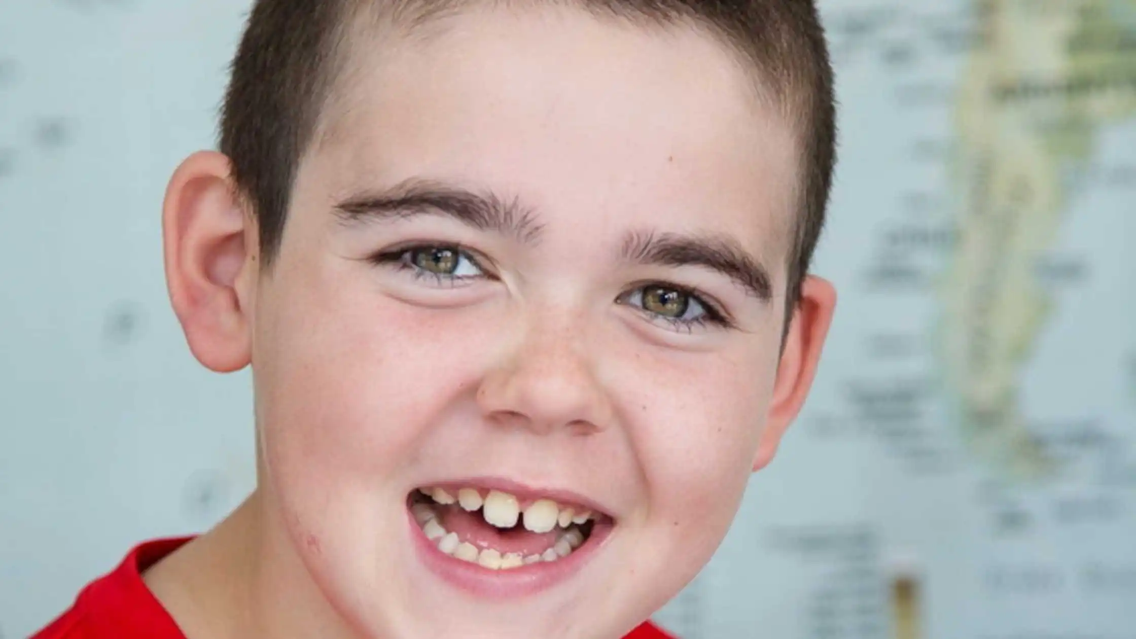 Alfie Dingley Elatedly Shares His Two Years Seizure free Experience with Medical Cannabis